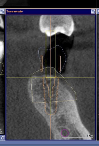 Capture xgjg7h - Eugenol