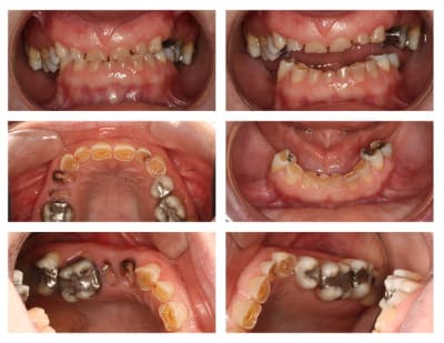 Cas 04 2010  2  ifaecy - Eugenol