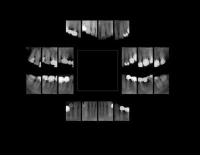 Chef d oeuvre ngap x1nst5 - Eugenol