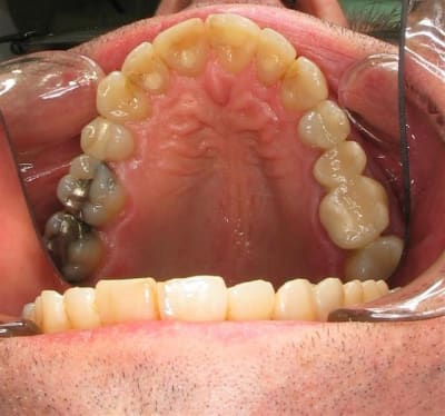Chevalier jm haut  large  i11kda - Eugenol