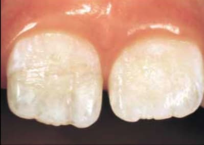 Cliché 2006 05 04 15 39 18 tg4zjz - Eugenol