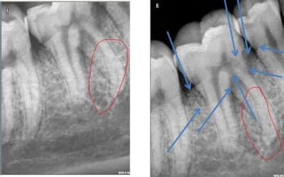 Clipboard pv4lnv - Eugenol
