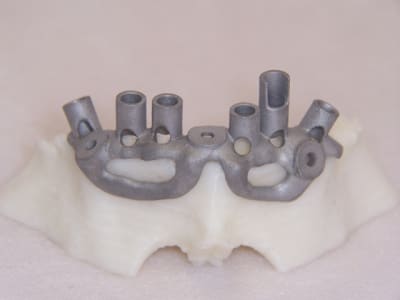 Complet haut et bas positdental 024 eryt8d - Eugenol