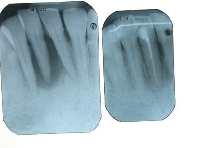 Copie de dscn2595 af4iup - Eugenol