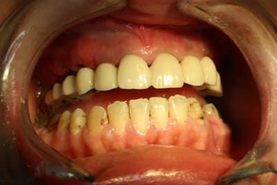 Copie de img 2223 fdyqus - Eugenol