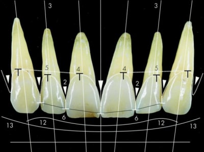 Crit res esth tiques hmtthq - Eugenol