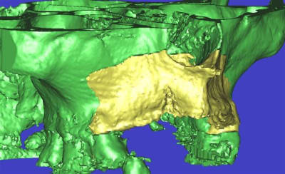 Dar3d5 rfltmz - Eugenol