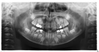 Doulet i 20111201 1010 xieidx - Eugenol