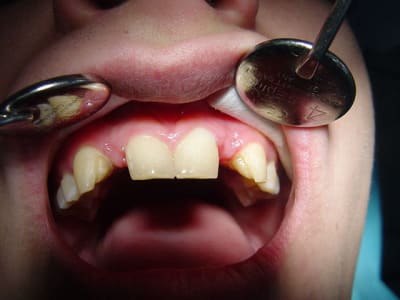 Dsc00086 ndjykx - Eugenol