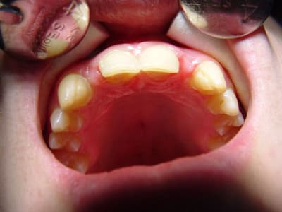 Dsc00087 fgms53 - Eugenol