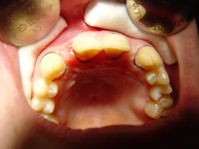 Dsc00092 jmfmzu - Eugenol