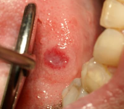 Dsc00455 f2vgwt - Eugenol