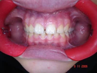 Dsc00927 drhsge - Eugenol