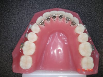 Dsc01000 aiatrz - Eugenol