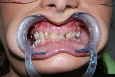 Dsc03298  1  q6p6nh - Eugenol