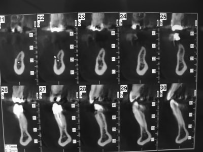 Dsc05916 pmivfn - Eugenol