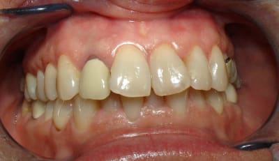 Dsc06108 kjhwu2 - Eugenol