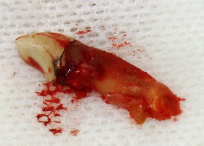 Dsc06182 x656lp - Eugenol