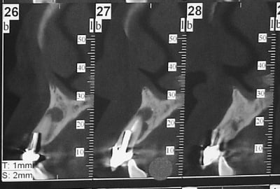 Dsc06184 n5ho2y - Eugenol