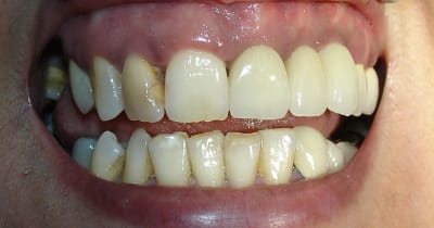 Dsc06197 rxd7ua - Eugenol