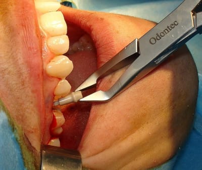 Dsc06461 rrwect - Eugenol