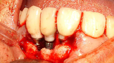 Dsc07991 dn28xt - Eugenol