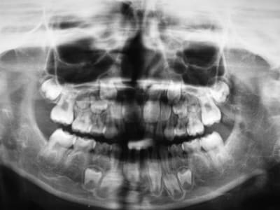 Dscf0016  large  q4tjkn - Eugenol