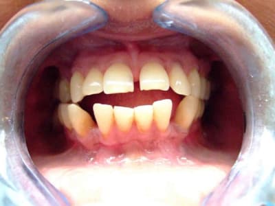 Dscf0538 z1lyl8 - Eugenol