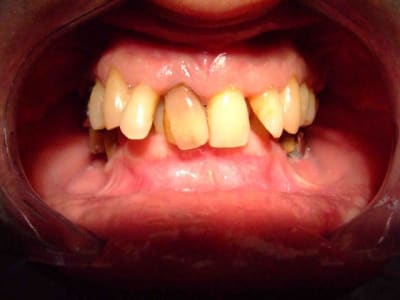 Dscf0546 nhjufl - Eugenol