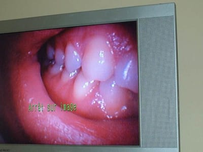 Dscf0689 roap7t - Eugenol