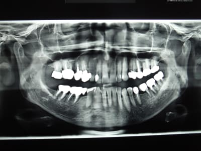 Dscf2219 vgoypm - Eugenol