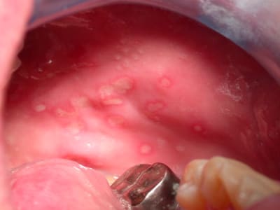 Dscn0004 tpp8tz - Eugenol