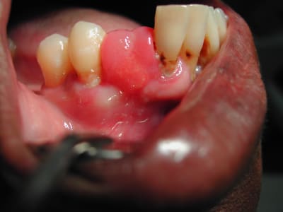 Dscn0328 ritqm1 - Eugenol