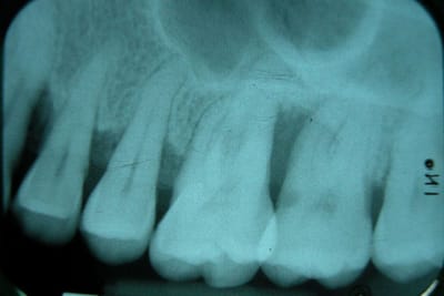 Dscn0608 p4dkh5 - Eugenol