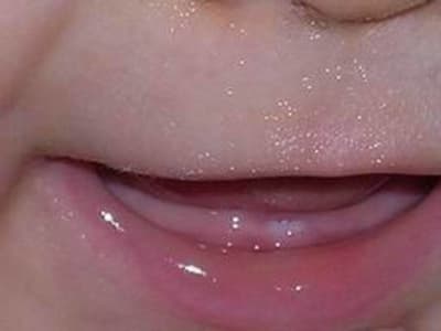 Dscn0710 yttzvu - Eugenol