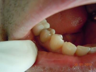 Dscn0750 x2wbw9 - Eugenol