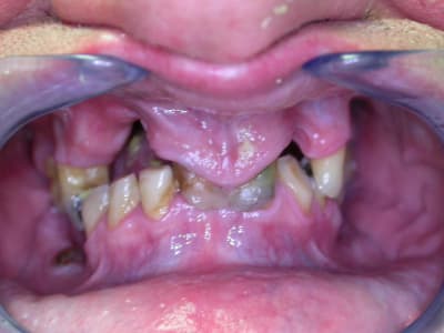 Dscn0788 dlq2wp - Eugenol