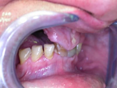 Dscn0789 xyuim4 - Eugenol