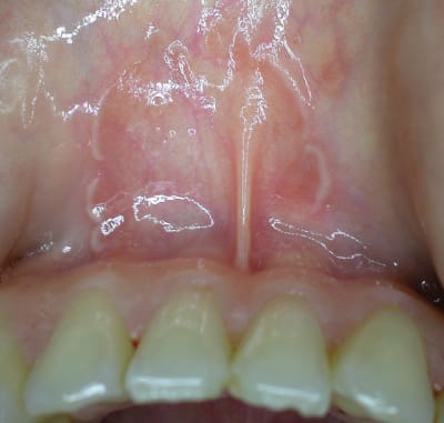 Dscn0923 qsikfu - Eugenol