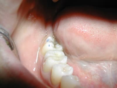 Dscn1586 i9gvss - Eugenol