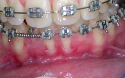 Dscn1645 gdpcme - Eugenol