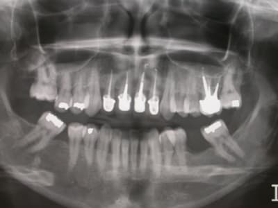 Dscn1713 h8hvgs - Eugenol