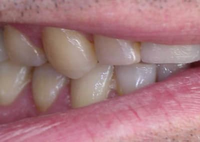 Dscn1943w n7h4b2 - Eugenol