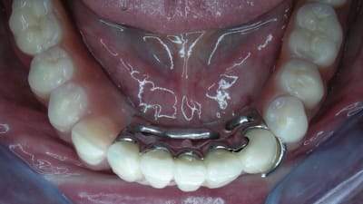 Dscn1999 sxmzdb - Eugenol