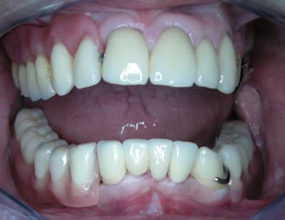 Dscn2000 aw1q5j - Eugenol