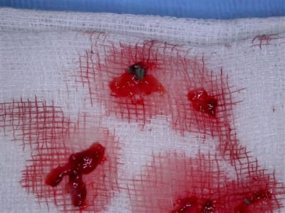 Dscn2061 fydgji - Eugenol