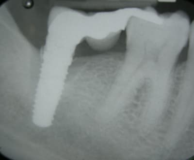 Dscn2125   copie evugyj - Eugenol