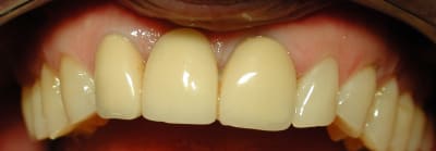 Dscn2200 u6qf7c - Eugenol