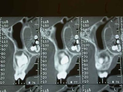 Dscn2561 bphker - Eugenol