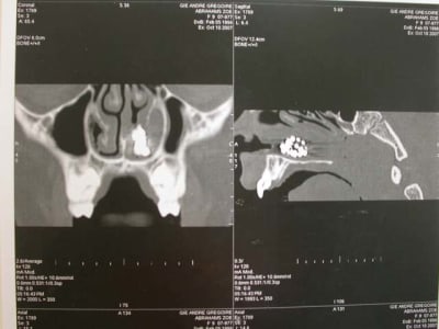 Dscn2653 deqbkb - Eugenol